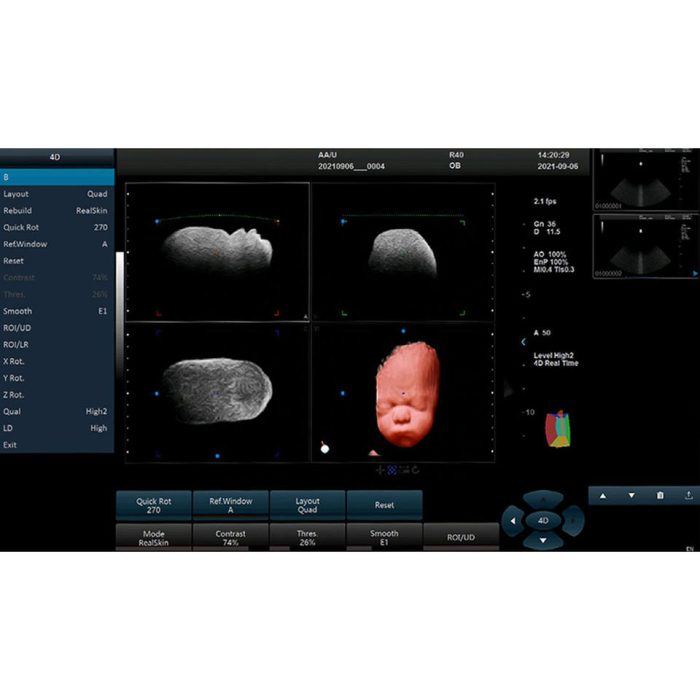 Good Quality Full Digital Ultrasound Machine