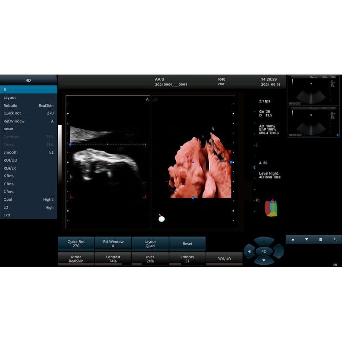 Good Quality Full Digital Ultrasound Machine