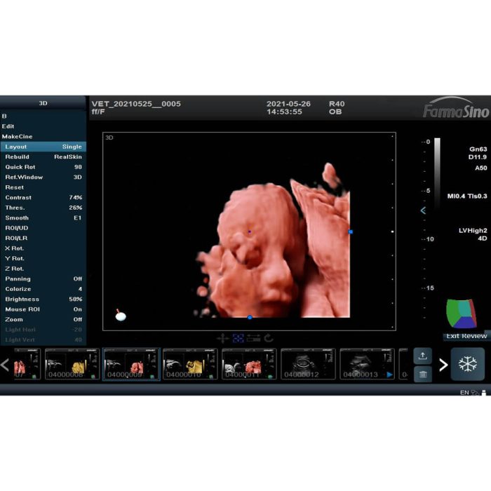 Good Quality Full Digital Ultrasound Machine